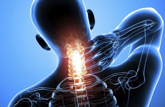 Pain in the neck