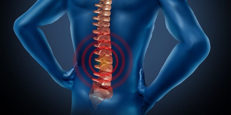 Osteochondrosis in the lumbar region