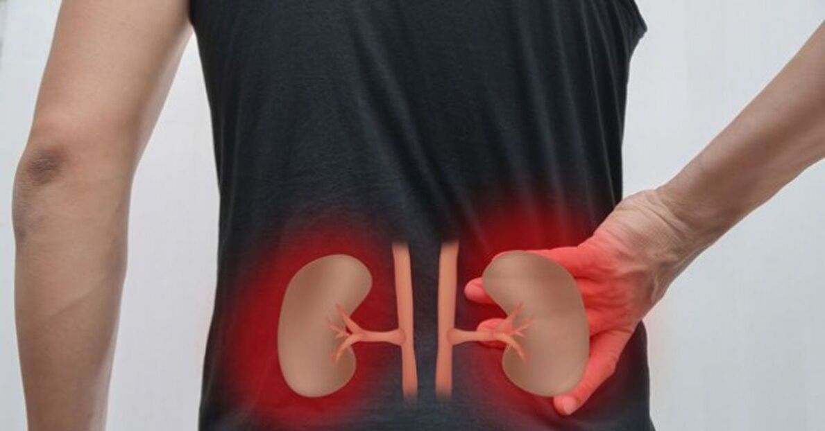 Inflammation of the kidneys can cause lower back pain